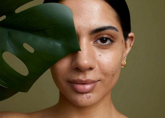 An acne Q+A with Dr. Rubin